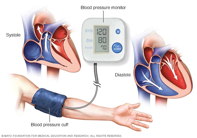 Tăng huyết áp (cao huyết áp) - Các giai đoạn và nguyên nhân?
