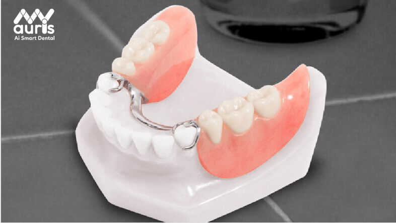 Phương pháp nào trồng răng cửa cố định tốt nhất?