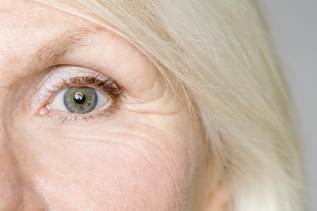 Làm thế nào khi xét nghiệm mắt có thể phát hiện bệnh alzheimer's