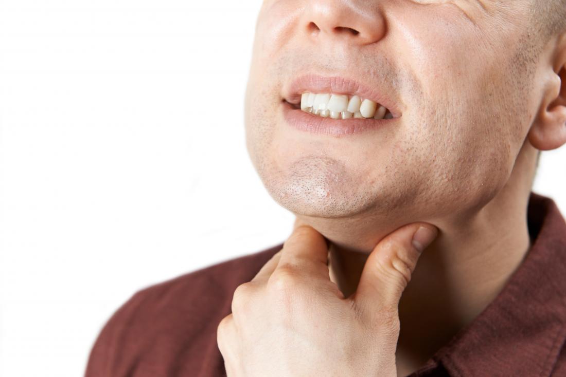 Những điều bạn nên biết về loét cổ họng