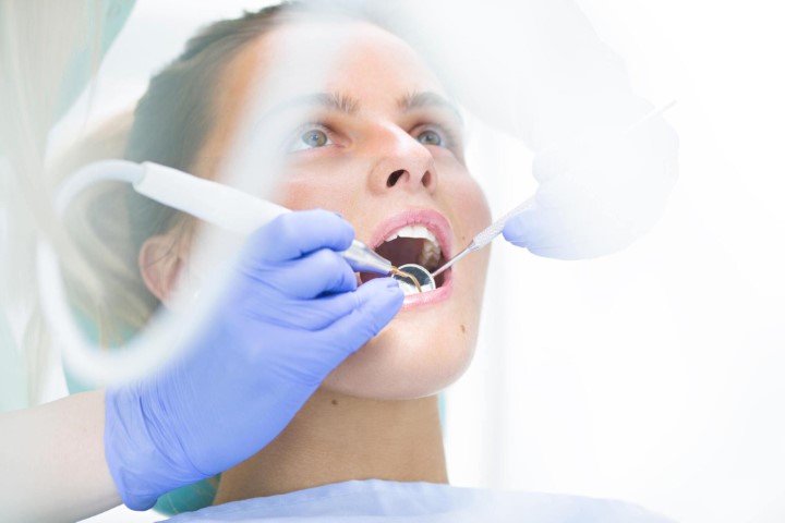 Chuyên gia giải đáp: mọi thắc mắc về trồng răng implant